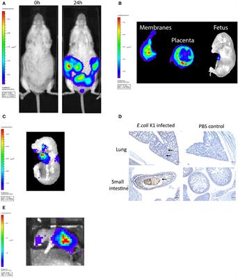 Cervical Gene Delivery of the Antimicrobial Peptide, Human β-Defensin (HBD)-3, in a Mouse Model of Ascending Infection-Related Preterm Birth